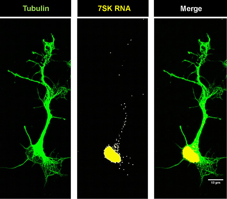 Localisation of the ZSK-RNA in motor neurons whose shape was represented by tubulin, a structural protein. (Photo: Hanaa Ghanawi)