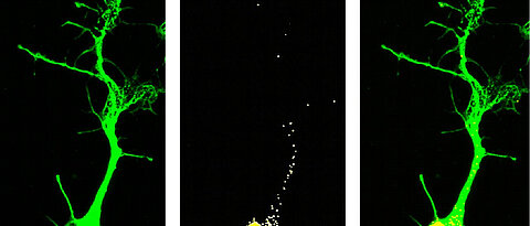 Localisation of the ZSK-RNA in motor neurons whose shape was represented by tubulin, a structural protein. (Photo: Hanaa Ghanawi)