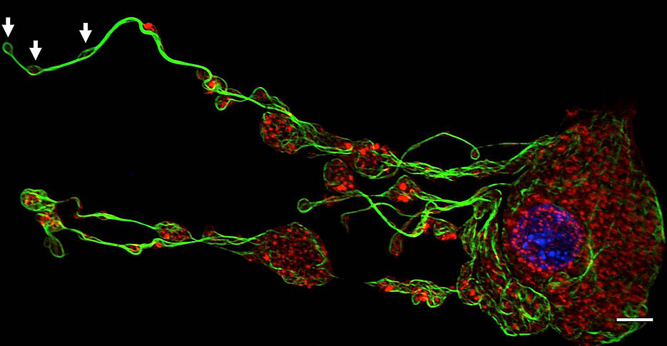 Emerging platelets (white arrows) are buded off by their progenitor cells, the megakaryocytes. Here the cytoskeletal components tubulin (green) and actin (red) and the nucleus (blue) are colored. (Picture: Rudolf Virchow Center)