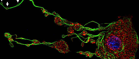 Emerging platelets (white arrows) are buded off by their progenitor cells, the megakaryocytes. Here the cytoskeletal components tubulin (green) and actin (red) and the nucleus (blue) are colored. (Picture: Rudolf Virchow Center)