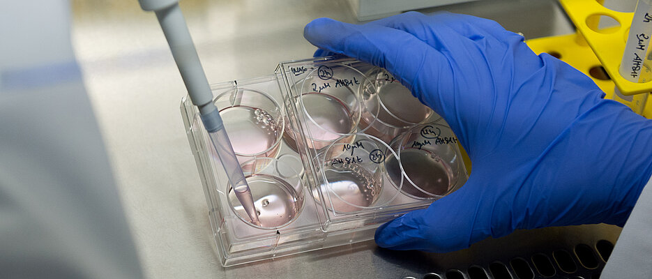 Dr. Daniela Brünnert arbeitet am Mittwoch
(04.02.15)  in einem Labor am Lehrstuhl für Translationale Onkologie an der Uniklinik in Würzburg. Im Rahmen des Comprehensive Cancer Cebters Mainfranken forschen Dr. Brünnert und ihre Kollegen an der Krankheit Multiples Myelom. Dabei geht es darum, potentielle neue Medikamente auf ihre Wirksamkeit hin zu testen und die molekularen Wirkmechanismen aufzuklären mit dem langfristigen Ziel, diese Medikamente in die Klinik zu bringen, damit Patienten besser als heute behandelt werden können.