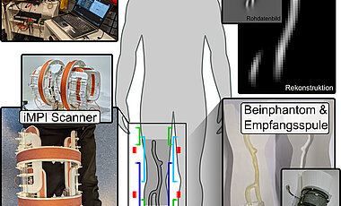 Der iMPI-Scanner ist so klein und leicht, dass man ihn fast überall mitnehmen und einsetzen kann. Das ist ein erster wichtiger Schritt hin zu einer strahlenfreien Intervention. 