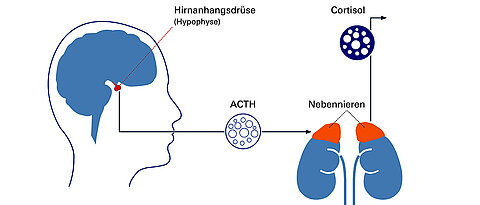 Das Cushing-Syndrom wird in den meisten Fällen durch gutartige Tumore der Hypophyse, eine erbsengroße Drüse unterhalb des Gehirns, ausgelöst. Durch den Tumor produziert diese sogenannte Hirnanhangsdrüse ungebremst das Hormon Adrenocorticotropin (ACTH), welches die Nebennieren antreibt, Cortisol auszuschütten.