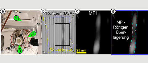 Der iMPI-Scanner (links) ermöglicht neue Einblicke in den menschlichen Körper. Hier zu sehen ist eine Engstelle in einem Blutgefäß – aufgenommen mit konventionellen Röntgenstrahlen (b), mit dem Scanner (c) und in einer Kombination beider Techniken (d). (Bild: Patrick Vogel / Stefan Herz)