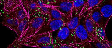 Dieses Fluoreszenz-Mikroskopiebild zeigt Campylobacter jejuni-Bakterien (grün), die menschliche Zellen (HeLa) infiziert haben. Die Zellkerne der menschlichen Wirtszellen sind in blau dargestellt und das Zellskelett (Aktin) in magenta.
