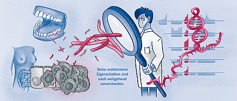 Das Fusobacterium im menschlichen Körper.