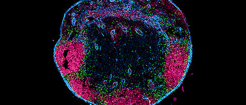 Cross-section through a lymph node. The unconventional T cells (green), which have migrated from the tissue via the lymphatic channels, are located in the marginal sinus and in the interfollicular zone. Follicular B cells are shown in magenta, the lymph node capsule and lymphatic vessels in blue. 