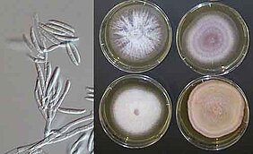 Ein Schimmelpilz der Gattung Fusarium unter dem Mikroskop (links) und in Laborkulturen. Fusarium ist einer der wichtigsten Erreger der Pilzkeratitis. (Bild: Nationales Referenzzentrum für Invasive Pilzinfektionen)