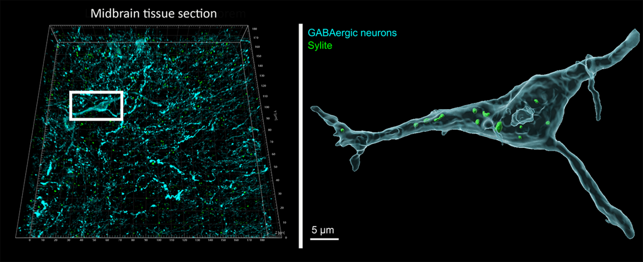 A Versatile Synthetic Affinity Probe Reveals Inhibitory Synapse  Ultrastructure and Brain Connectivity** - Khayenko - 2022 - Angewandte  Chemie International Edition - Wiley Online Library