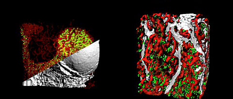 Die mit Hilfe der Lichtblatt-Fluoreszenzmikroskopie produzierten Bilder zeigen links die Rekonstruktion eines Maus-Unterschenkelknochens. Megakaryozyten (grün) sind eingebettet in ein dichtes Gefäßnetzwerk (rot) und Knochengewebe (grau). Rechts ist die