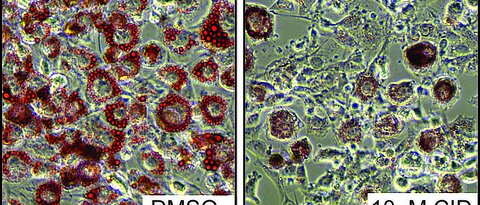 Fettzellen, die während ihrer Differenzierung mit einem PKD-Hemmstoff behandelt wurden (Abbildung rechts), speichern sehr viel weniger Fetttröpfchen (rot) als unbehandelte Zellen (Abbildung links). 