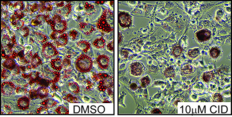 Fettzellen, die während ihrer Differenzierung mit einem PKD-Hemmstoff behandelt wurden (Abbildung rechts), speichern sehr viel weniger Fetttröpfchen (rot) als unbehandelte Zellen (Abbildung links). 