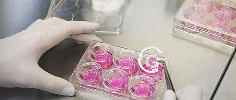 Zellbasierte Gewebemodelle zum Testen von Wirkstoffen.
