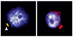Fluorescence microscopy showing on the left, a macrophage (nucleus in blue) infected with a non-replicating bacteria in yellow indicated by an arrow and on the right infected with bacteria that has replicated (red). (Picture: Antoine-Emmanuel Saliba)