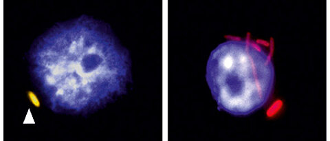 Fluorescence microscopy showing on the left, a macrophage (nucleus in blue) infected with a non-replicating bacteria in yellow indicated by an arrow and on the right infected with bacteria that has replicated (red). (Picture: Antoine-Emmanuel Saliba)