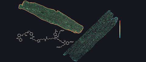 Beta1- and beta2-adrenergic receptors in heart muscle cells: In the left cell, beta1 receptors are labeled – they are found both on the cell surface (yellow) and in the T-tubules (green). In the right cell, the beta2-receptors are labeled – they appear only in the T-tubules (green), but not on the cell surface (which is therefore not visible in the image).