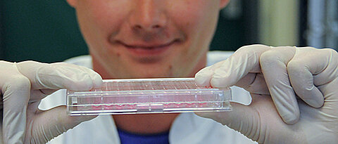Doktorand Sebastian Jarzina zeigt eine Zellkulturplatte, in der Nierenzellen wachsen. (Foto: Robert Emmerich)