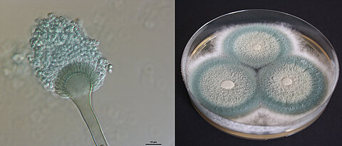 Der Schimmelpilz Aspergillus fumigatus nach mehreren Wochen Wachstum auf Nährmedium (rechts). Die blau-grüne Oberflächenpigmentierung ist charakteristisch für die Schimmelpilzkolonien. Daneben die mikroskopische Aufnahme eines Konidienträgers. Die wenige Mikrometer großen Sporen werden über den Luftweg verbreitet. Insbesondere bei immungeschwächten Personen können sie schwere Atemwegsinfektionen auslösen. 