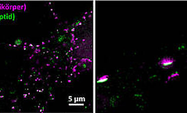 Synapses of brain cells: Here, the pre-synapses are tagged conventionally with antibodies (red); the post-synapses are labelled with special peptides which clearly enhances resolution.