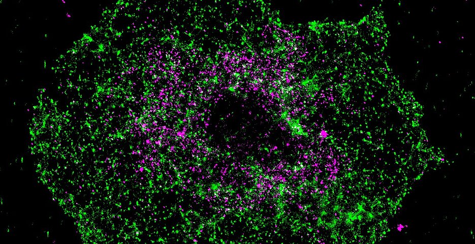 Aufklärung der Kolokalisierung von BIN2 (grün) und STIM1 (magenta) mit Hilfe von superhochauflösender Fluoreszenzmikroskopie (dSTORM) im aktivierten Blutplättchen.