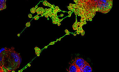 Mikroskopaufnahme eines Megakaryozyten im Prozess der Blutplättchenbildung. Die langen Ausläufer sind durch Mikrotubuli (grün) und Aktinfilamente (rot) charakterisiert. Die kugelförmigen Verdickungen repräsentieren unreife Blutplättchen. Die DNA im 