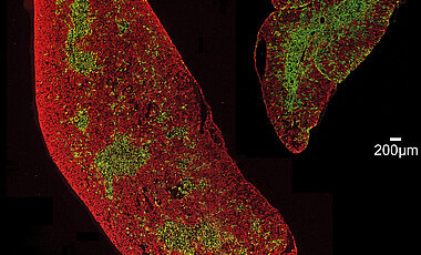 Die feingewebliche Struktur des stimulierten Thymusorgans unterscheidet sich nicht von dem eines unstimulierten Organs. Als Zeichen eines gut funktionierenden Thymus sind die Randbereiche (rot) und Innenzonen (grün) scharf voneinander abgetrennt. 