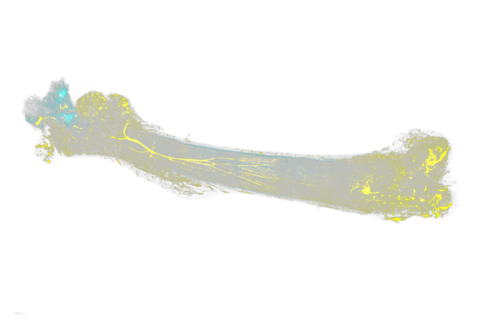 Light-sheet fluorescence image of a cleared mouse femur bone. CD31-postive vessels are shown in yellow, while CH105high vessels are shown in cyan