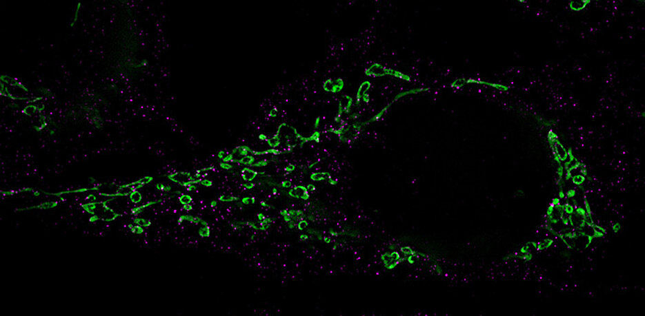 Microscopy showing the fragmentation of mitochondria