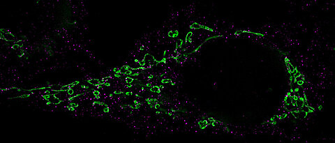 Mikroskopische Aufnahme, die den Zerfall der Mitochondrien zeigt.