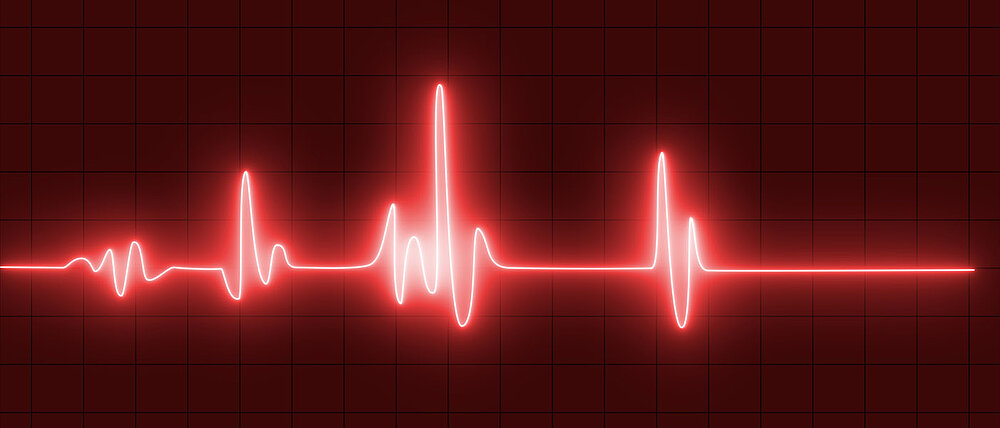 Visualisierung eines Herzrhythmus in rot auf schwarzem Hintergrund.