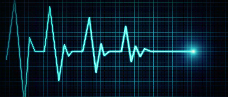 Vorhofflimmern zählt zu den relevantesten Schlaganfall-Risikofaktoren. Ein EKG gehört deshalb zur Standarddiagnostik nach einem Schlaganfall. 