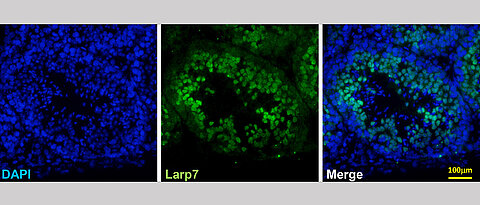 LARP7 expression in the germline of mice. An immune staining of the protein (green) is shown, the cell nuclei are marked blue with a dye (DAPI). (Picture: AG Mofang Liu / Chinese Academy of Sciences)