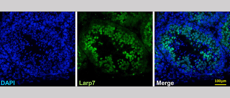 LARP7 expression in the germline of mice. An immune staining of the protein (green) is shown, the cell nuclei are marked blue with a dye (DAPI). (Picture: AG Mofang Liu / Chinese Academy of Sciences)