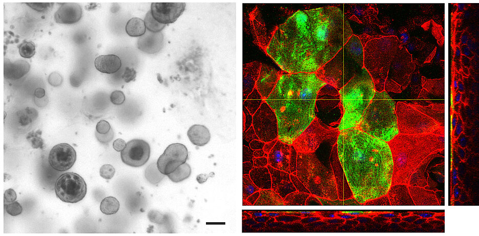 Organoid-based models: bladder organoids