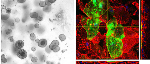 Organoid-basierte Modelle: Blasenorganoide (linkes Bild) werden verwendet, um ein komplexeres, auf Blasenorganoiden basierendes Modell (rechtes Bild) zu entwickeln. Dieses enthält differenzierte oberflächliche Schirmzellen (in grün) und darunter mehrere Zellschichten, was insgesamt das Blasenepithel nachahmt. Uroplakin 3a in grün, Aktin in rot und Zellkerne in blau. 
