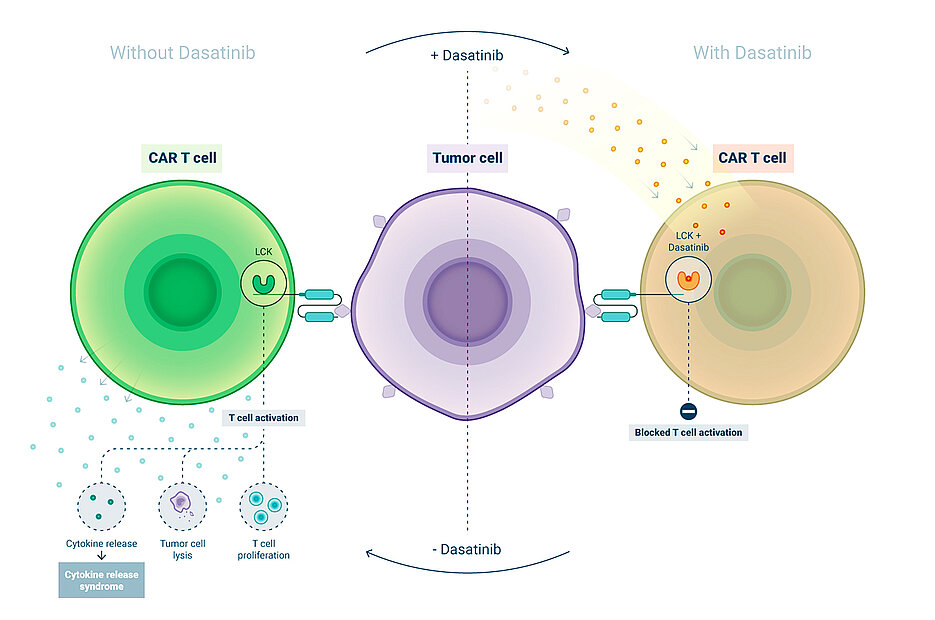 Das Krebsmedikament Dasatinib hemmt die Aktivierung von CAR-T-Zellen und kann eingesetzt werden, um schwerwiegende Nebenwirkungen der CAR-T-Zelltherapie zu bekämpfen.