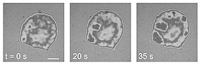 Snapshots of the bond of a giant vesicle on a plane model membrane. Dark pixels mark the points of contact between the membranes. They grow larger and more numerous over time. (Picture: Susanne Fenz)