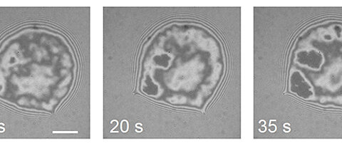 Snapshots of the bond of a giant vesicle on a plane model membrane. Dark pixels mark the points of contact between the membranes. They grow larger and more numerous over time. (Picture: Susanne Fenz)