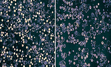 Links ruhende Chlamydien (helle Kreise), die ohne Glutamin gehalten werden. Nach der Zugabe von Glutamin (rechts) gehen die Bakterien in die Teilungsstadien über (dunklere Kreise).