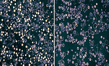 Resting Chlamydia (left; bright circles), which are held without glutamine. After the addition of glutamine (right) the bacteria enter the division stages (darker circles).