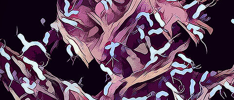 Artistic representation of human stomach cells infected with Helicobacter pylori, showing the special Hummingbird cell shape induced by the bacterium.