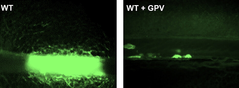 Treatment with soluble GPV prevents the formation of a vessel-occluding thrombus in an experimental mouse model of thrombosis formation (right). On the left, a vessel-occluding thrombus of an untreated mouse is shown.