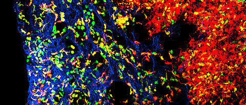 The figure shows the complex organization of dendritic cells in the lymph node. Blood vessels are shown in blue. The cells in green are young dendritic cells whereas the dendritic cells in red are a few days older and have already migrated. The dendritic cells in orange are intermediate in age.